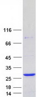 RAB22A / RAB22 Protein - Purified recombinant protein RAB22A was analyzed by SDS-PAGE gel and Coomassie Blue Staining