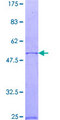 RAB23 Protein - 12.5% SDS-PAGE of human RAB23 stained with Coomassie Blue