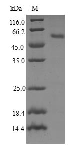 RAB23 Protein - (Tris-Glycine gel) Discontinuous SDS-PAGE (reduced) with 5% enrichment gel and 15% separation gel.