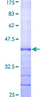 RAB23 Protein - 12.5% SDS-PAGE Stained with Coomassie Blue.