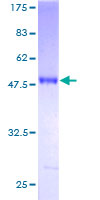 RAB24 Protein - 12.5% SDS-PAGE of human RAB24 stained with Coomassie Blue