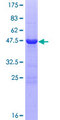 RAB25 Protein - 12.5% SDS-PAGE of human RAB25 stained with Coomassie Blue