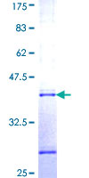 RAB25 Protein - 12.5% SDS-PAGE Stained with Coomassie Blue