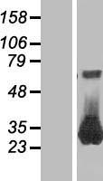 RAB26 Protein - Western validation with an anti-DDK antibody * L: Control HEK293 lysate R: Over-expression lysate