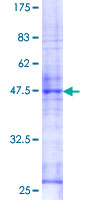 RAB26 Protein - 12.5% SDS-PAGE of human RAB26 stained with Coomassie Blue
