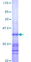 RAB26 Protein - 12.5% SDS-PAGE Stained with Coomassie Blue.