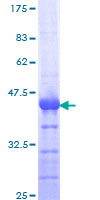 RAB27A / RAB27 Protein - 12.5% SDS-PAGE Stained with Coomassie Blue.