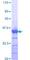 RAB27A / RAB27 Protein - 12.5% SDS-PAGE Stained with Coomassie Blue.