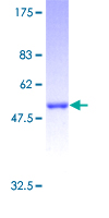 RAB27B Protein - 12.5% SDS-PAGE of human RAB27B stained with Coomassie Blue