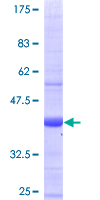 RAB28 Protein - 12.5% SDS-PAGE of human RAB28 stained with Coomassie Blue
