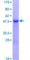RAB28 Protein - 12.5% SDS-PAGE of human RAB28 stained with Coomassie Blue