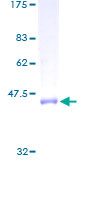 RAB2A / RAB2 Protein - 12.5% SDS-PAGE of human RAB2 stained with Coomassie Blue