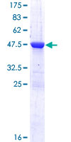 RAB2A / RAB2 Protein - 12.5% SDS-PAGE of human RAB2A stained with Coomassie Blue