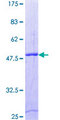 RAB2B Protein - 12.5% SDS-PAGE of human RAB2B stained with Coomassie Blue