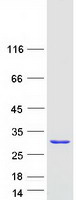 RAB2B Protein - Purified recombinant protein RAB2B was analyzed by SDS-PAGE gel and Coomassie Blue Staining