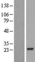 RAB30 Protein - Western validation with an anti-DDK antibody * L: Control HEK293 lysate R: Over-expression lysate