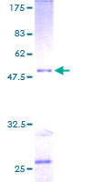 RAB30 Protein - 12.5% SDS-PAGE of human RAB30 stained with Coomassie Blue