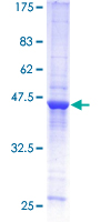 RAB31 Protein - 12.5% SDS-PAGE of human RAB31 stained with Coomassie Blue