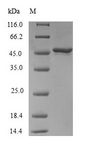 RAB31 Protein - (Tris-Glycine gel) Discontinuous SDS-PAGE (reduced) with 5% enrichment gel and 15% separation gel.