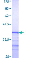 RAB31 Protein - 12.5% SDS-PAGE Stained with Coomassie Blue.