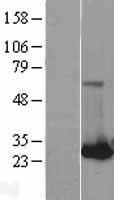 RAB32 Protein - Western validation with an anti-DDK antibody * L: Control HEK293 lysate R: Over-expression lysate
