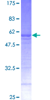 RAB32 Protein - 12.5% SDS-PAGE of human RAB32 stained with Coomassie Blue