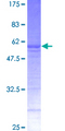 RAB32 Protein - 12.5% SDS-PAGE of human RAB32 stained with Coomassie Blue