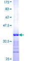 RAB32 Protein - 12.5% SDS-PAGE Stained with Coomassie Blue.