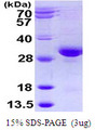 RAB32 Protein
