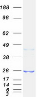 RAB32 Protein - Purified recombinant protein RAB32 was analyzed by SDS-PAGE gel and Coomassie Blue Staining