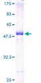 RAB33A Protein - 12.5% SDS-PAGE of human RAB33A stained with Coomassie Blue