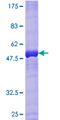 RAB33B Protein - 12.5% SDS-PAGE of human RAB33B stained with Coomassie Blue