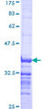 RAB33B Protein - 12.5% SDS-PAGE Stained with Coomassie Blue.