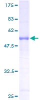 RAB34 Protein - 12.5% SDS-PAGE of human RAB34 stained with Coomassie Blue