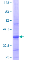 RAB34 Protein - 12.5% SDS-PAGE Stained with Coomassie Blue.