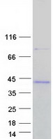 RAB34 Protein - Purified recombinant protein RAB34 was analyzed by SDS-PAGE gel and Coomassie Blue Staining