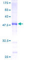 RAB35 Protein - 12.5% SDS-PAGE of human RAB35 stained with Coomassie Blue