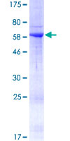 RAB36 Protein - 12.5% SDS-PAGE of human RAB36 stained with Coomassie Blue