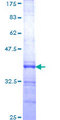 RAB36 Protein - 12.5% SDS-PAGE Stained with Coomassie Blue.