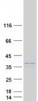RAB36 Protein - Purified recombinant protein RAB36 was analyzed by SDS-PAGE gel and Coomassie Blue Staining