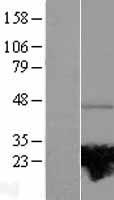 RAB37 Protein - Western validation with an anti-DDK antibody * L: Control HEK293 lysate R: Over-expression lysate