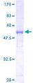 RAB37 Protein - 12.5% SDS-PAGE of human RAB37 stained with Coomassie Blue