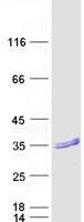 RAB37 Protein - Purified recombinant protein RAB37 was analyzed by SDS-PAGE gel and Coomassie Blue Staining