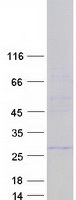 RAB37 Protein - Purified recombinant protein RAB37 was analyzed by SDS-PAGE gel and Coomassie Blue Staining