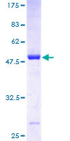 RAB38 Protein - 12.5% SDS-PAGE of human RAB38 stained with Coomassie Blue
