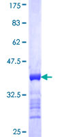 RAB38 Protein - 12.5% SDS-PAGE Stained with Coomassie Blue.