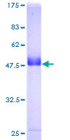 RAB39 / RAB39A Protein - 12.5% SDS-PAGE of human RAB39 stained with Coomassie Blue