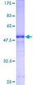 RAB39B Protein - 12.5% SDS-PAGE of human RAB39B stained with Coomassie Blue
