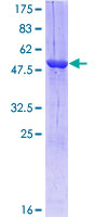 RAB3A Protein - 12.5% SDS-PAGE of human RAB3A stained with Coomassie Blue