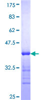 RAB3A Protein - 12.5% SDS-PAGE Stained with Coomassie Blue.